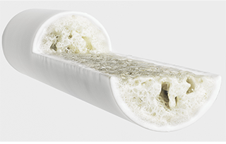 OSTEOPENIA""